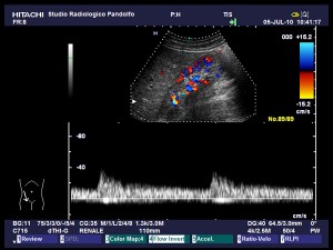 Eco Color Doppler Studio Radiologico Pandolfo Diagnostica Per